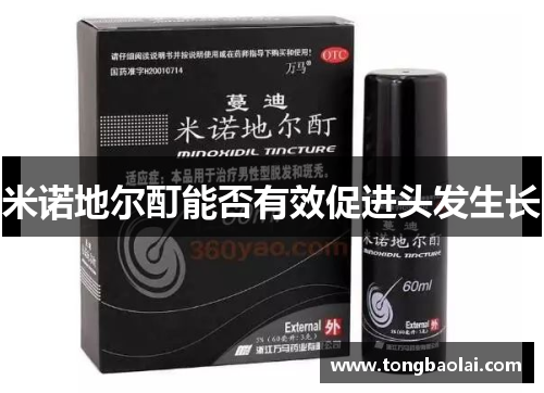 米诺地尔酊能否有效促进头发生长